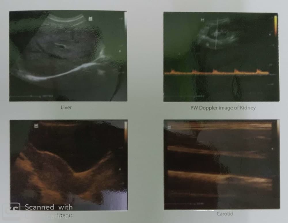 Mindray DP-25 Power Digital Ultrasonic Imaging System