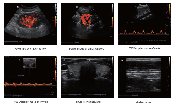 Mindray DP-30 Power Digital Ultrasonic Imaging System